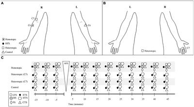 Long-term bilateral change in pain and sensitivity to high-frequency cutaneous electrical stimulation in healthy subjects depends on stimulus modality: a dermatomal examination